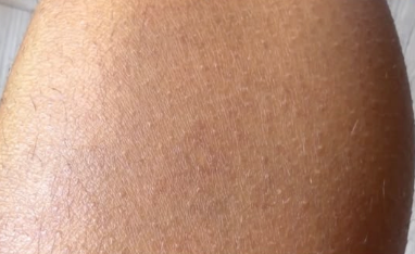 Après
